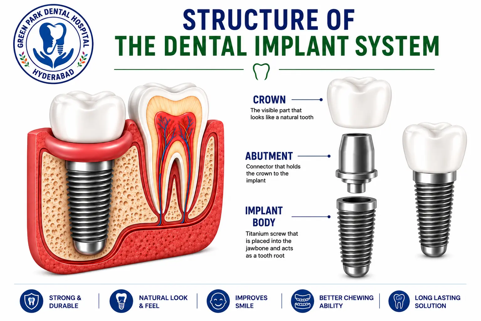 dental implants green park denta