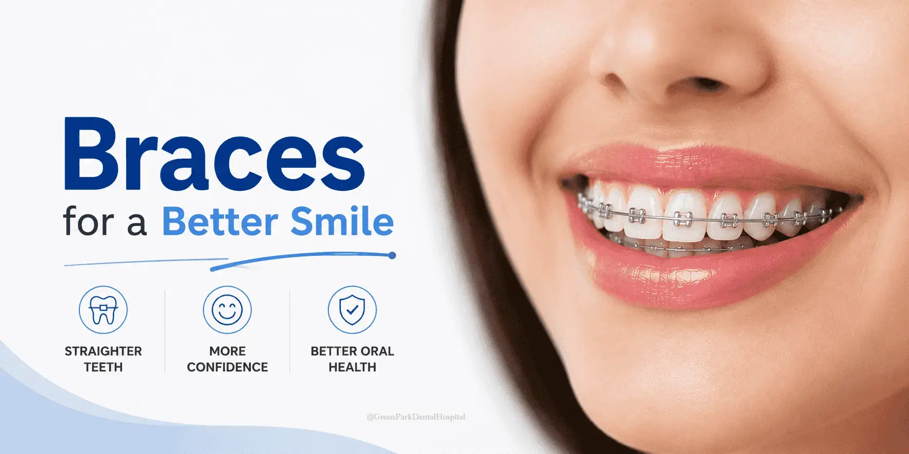 Braces