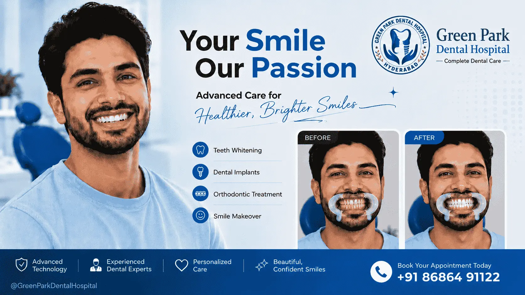Teeth Whitening