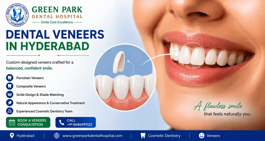 Dental Veneers
