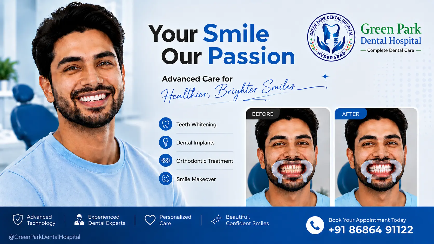Teeth Whitening